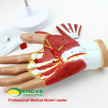 MUSCLE08(12031) Human Hand Anatomy Muscle 4-Parts Medical Education Model 12031